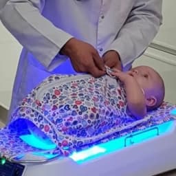 Облучатель фототерапевтический ОФТН-03 с гамаком — миниатюра 3